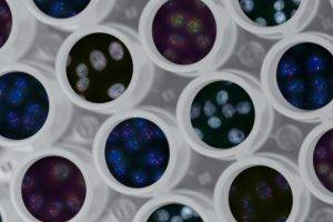 Триизмерен пейзаж на генома. HIPMap (Highthroughput imaging position mapping) точно определя позицията на даден ген в триизмерното (3D) пространство на клетъчното ядро. На тази илюстрация изображенията на гените (червени, зелени и сини петна в ядрата на клетките HeLa) са изкуствено наложени върху изображения на многоядкови плаки. Снимка: National Cancer Institute, Unsplash
