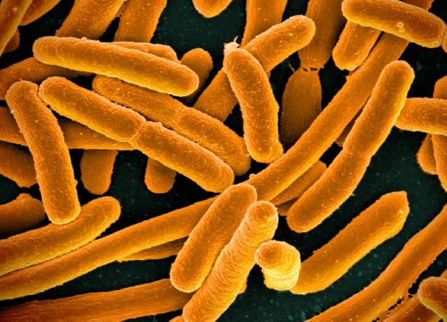 Оцветена сканираща електронна микроскопска снимка на Escherichia color, отгледана в култура и прилепнала към покривно стъкло. Това може да е основа за ново бактериологично оръжие. Източник: National Institute of Allergy and Infectious Diseases, National Institutes of Health